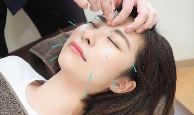 美容鍼