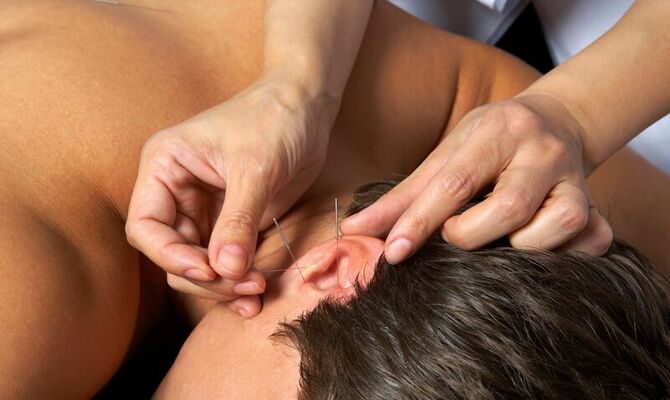 耳に鍼を打つ