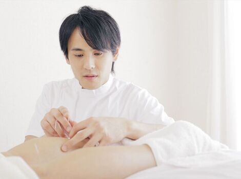 鍼治療を行うスタッフ