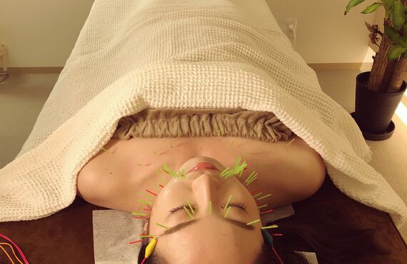 ニキビ跡でお悩みの方、岡崎市の美容鍼灸サロンHARISUKEがおすすめ！