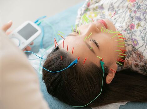 美容鍼　写真_R