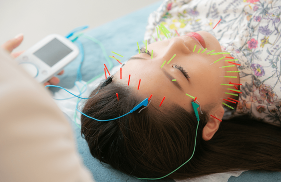 岡崎市の美容鍼灸サロンHARISUKEはニキビ施術が得意です！